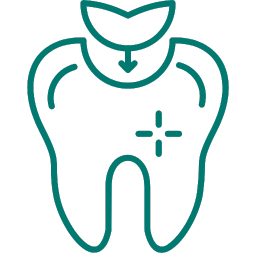 Esthetic Tooth Restoration (Filling)