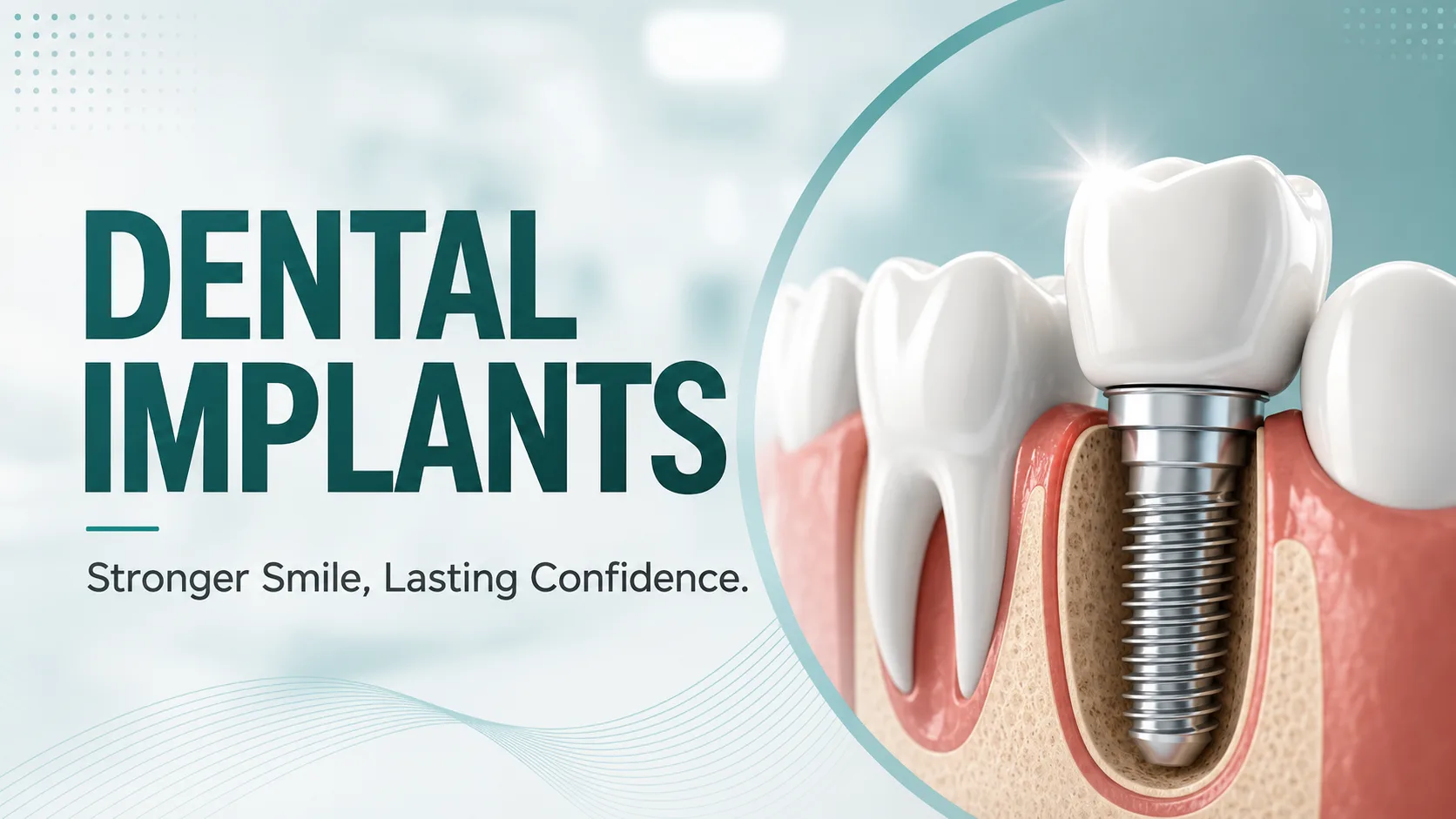 Dental Implant Cost in Siliguri