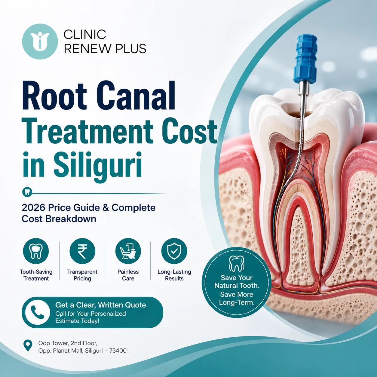 Root Canal Treatment Cost in Siliguri 2026